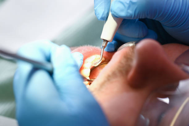 Best Emergency Dentist for Knocked-Out Tooth in Blacklick Estates, OH