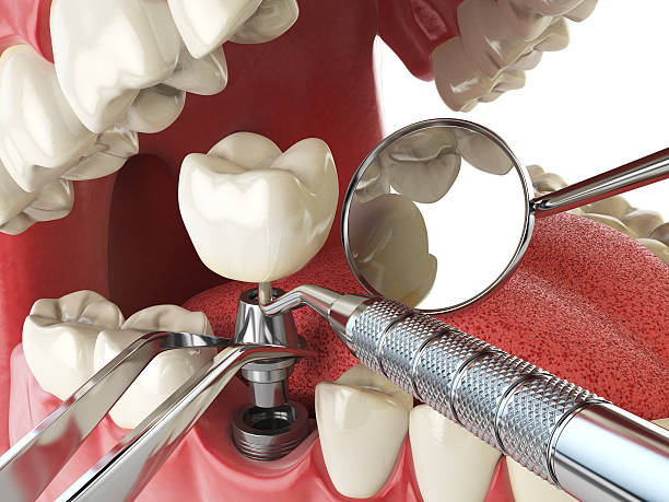 Best Broken or Cracked Tooth Emergency Dentist in Blacklick Estates, OH